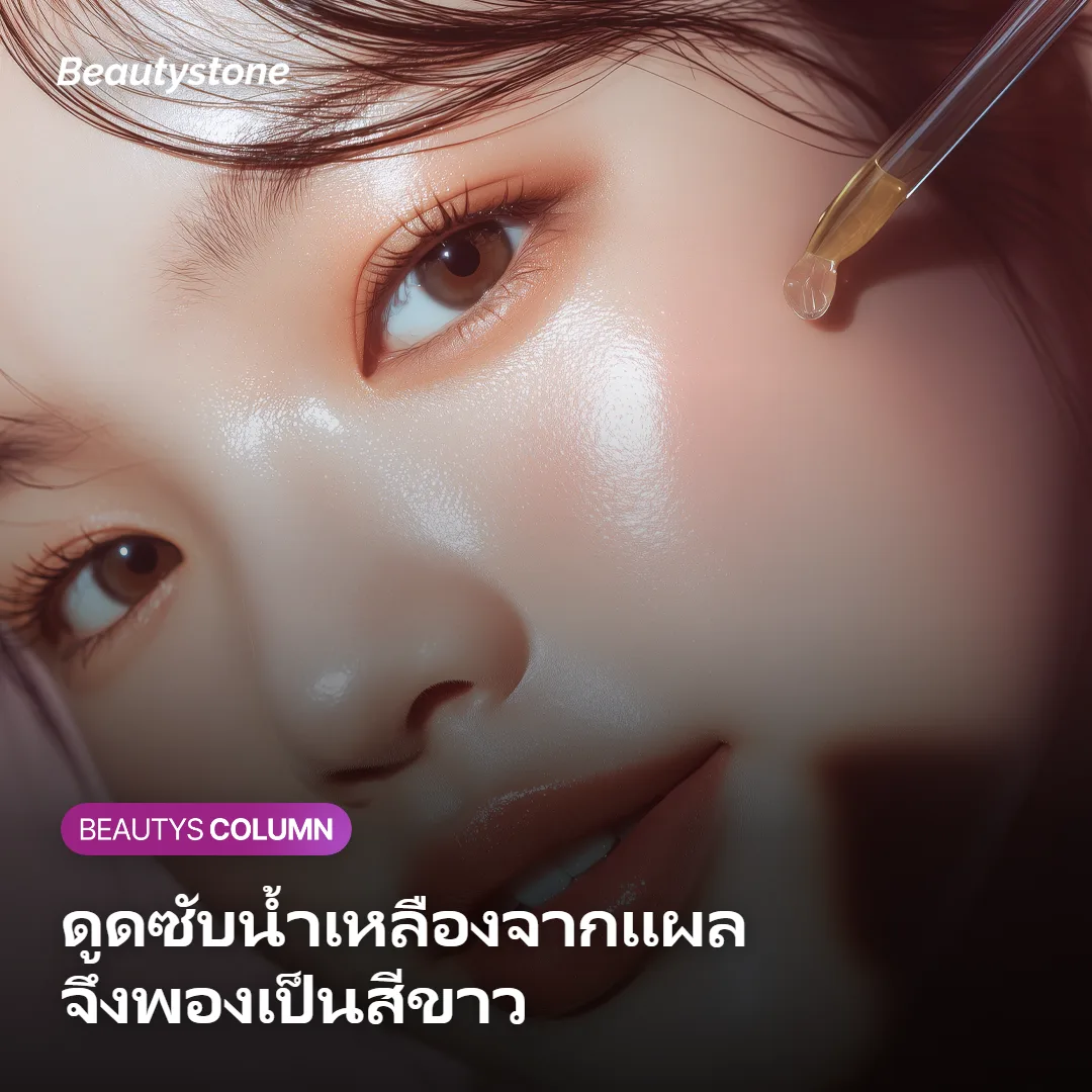 ภาพแสดงกลไกดูโอเดิร์มดูดซับน้ำเหลืองจากแผล