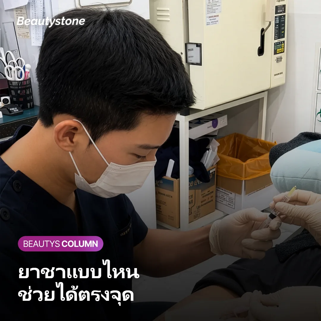 ภาพแสดงตัวช่วยลดความเจ็บของ Ultraformer (Shurink) เช่น ยาชาแบบครีมและยาชาเฉพาะจุด