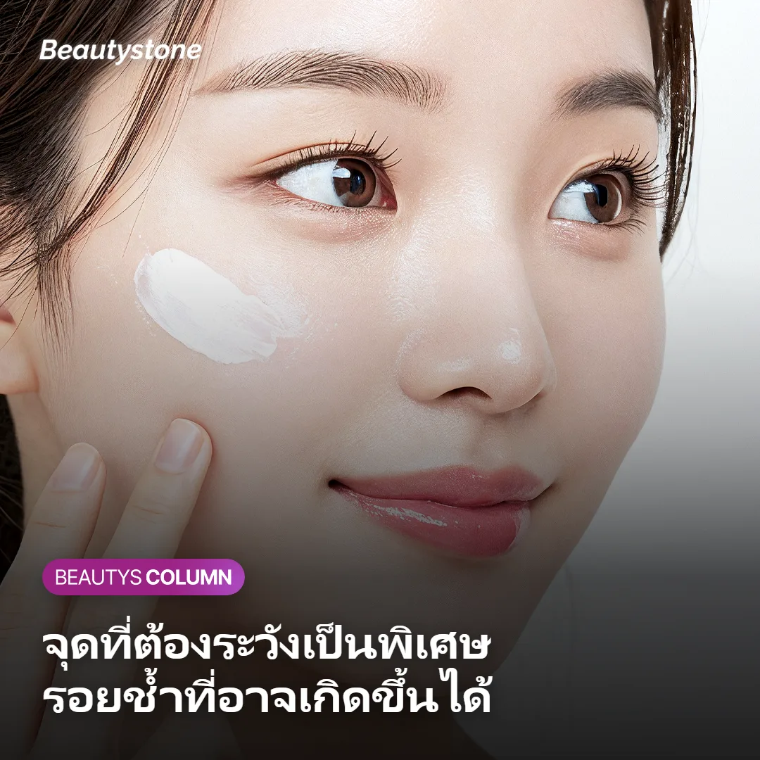 ภาพแสดงข้อควรระวังเรื่องเส้นเลือดและรอยช้ำหลังฉีดฟิลเลอร์ใต้ริมฝีปาก