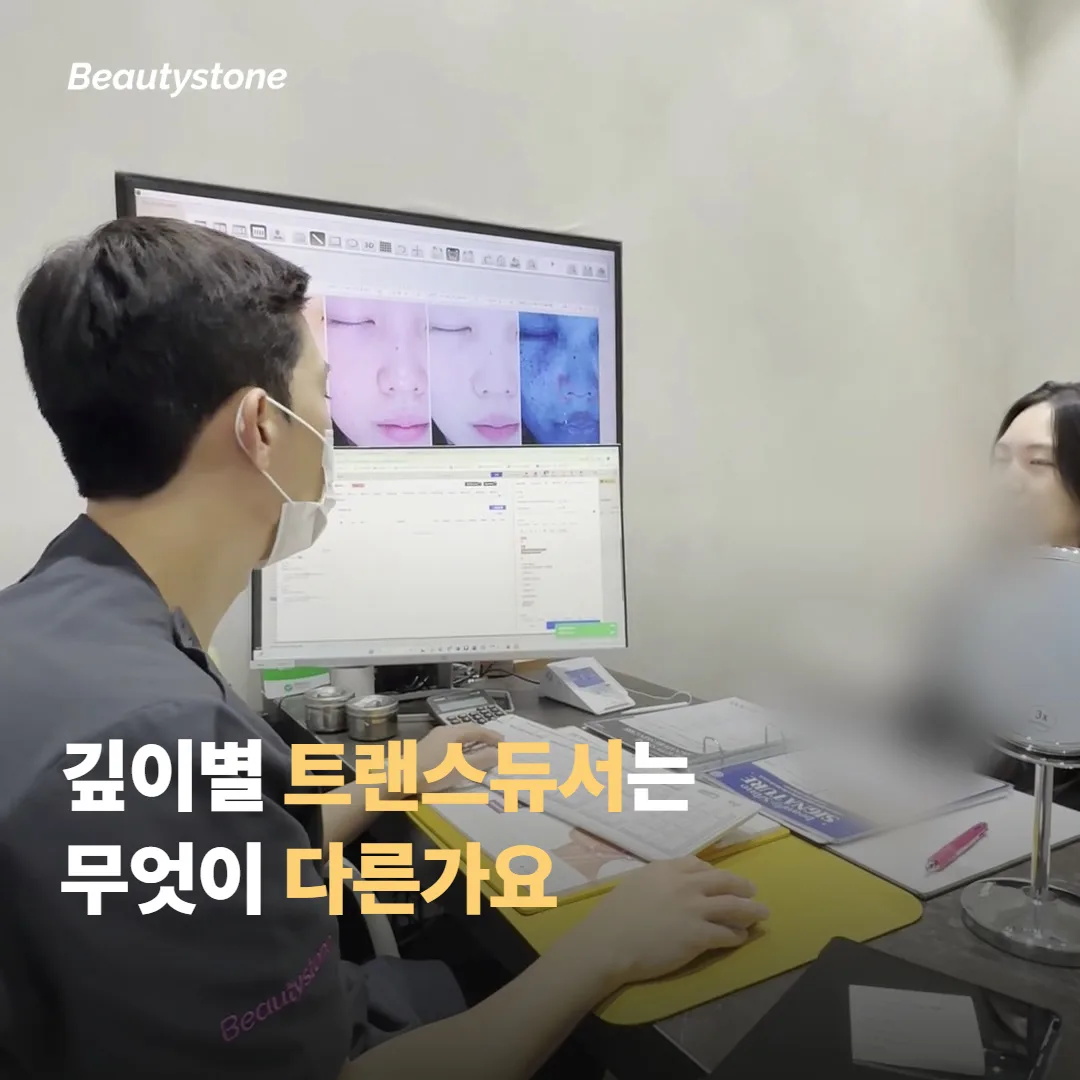 깊이별 트랜스듀서는 무엇이 다른가요