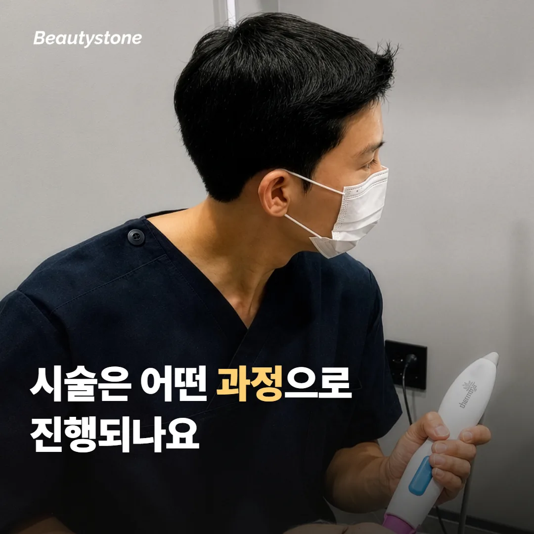 시술은 어떤 과정으로 진행되나요