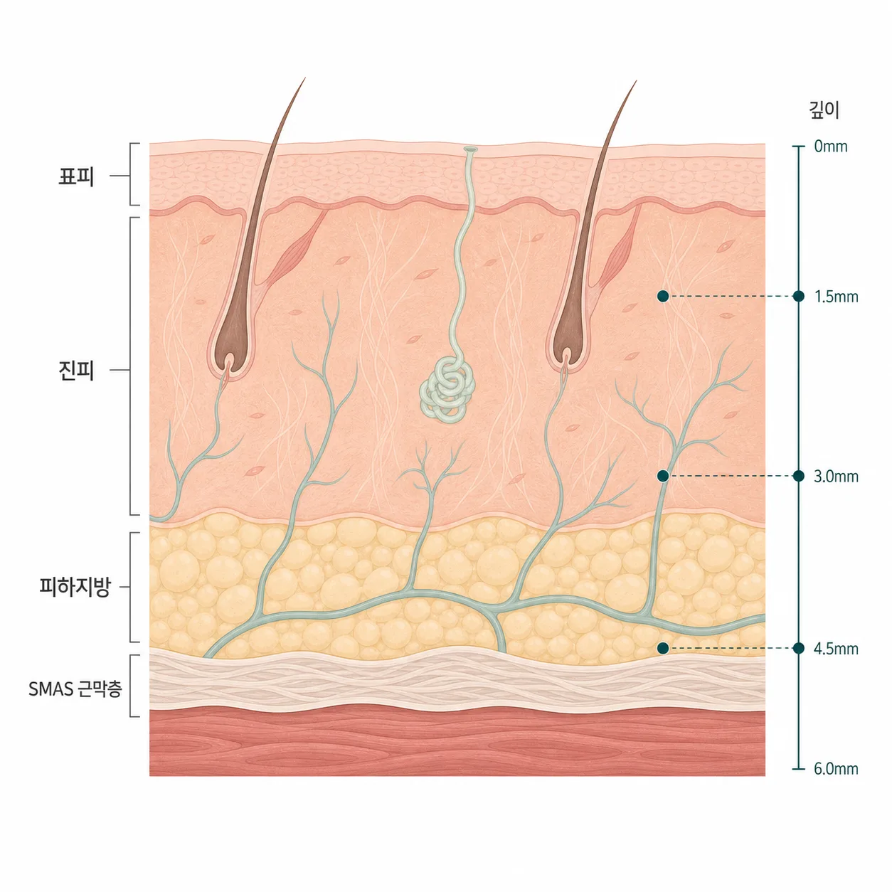 얼굴 피부층과 그 아래 SMAS 근막층의 깊이