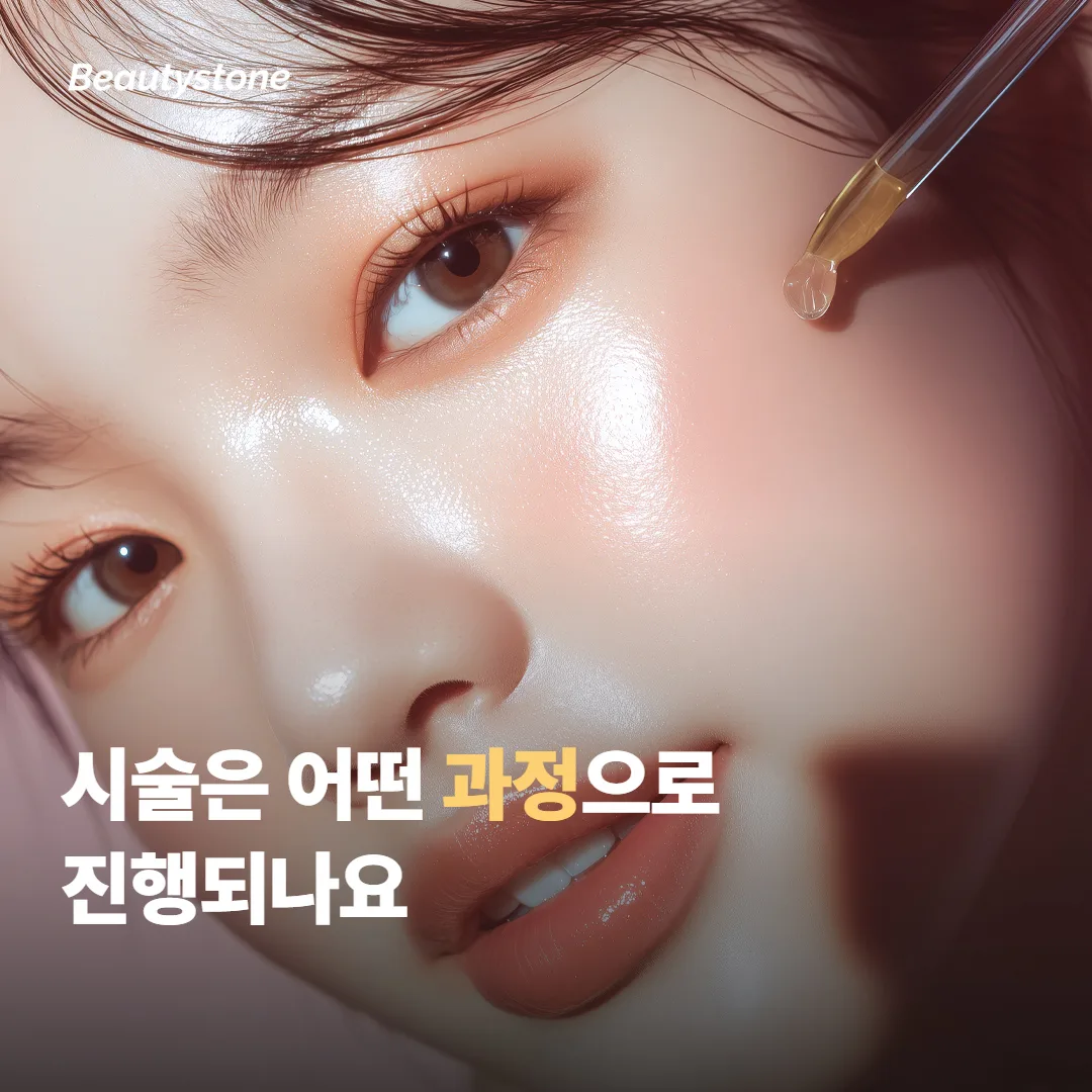 시술은 어떤 과정으로 진행되나요