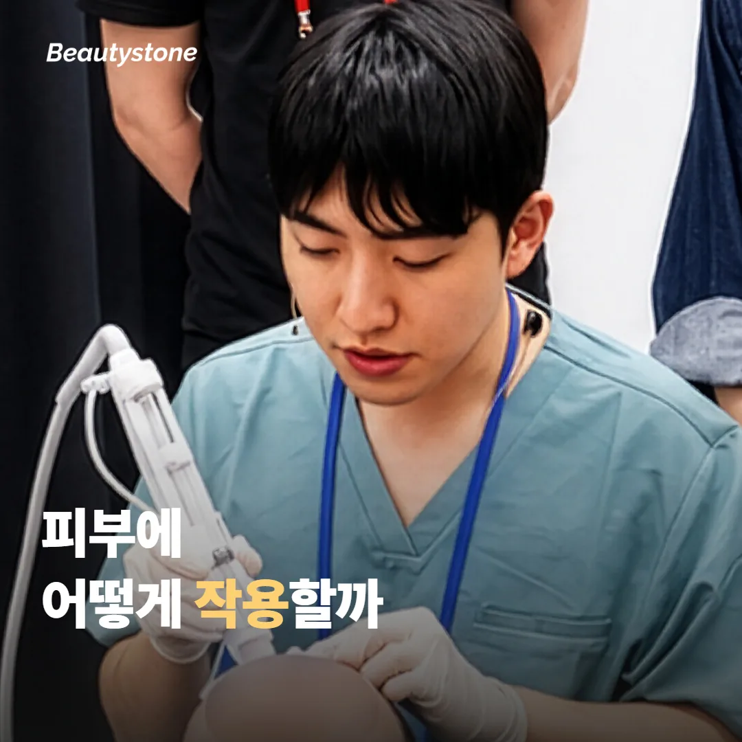 인모드 FX는 어떤 방식으로 피부에 작용할까요