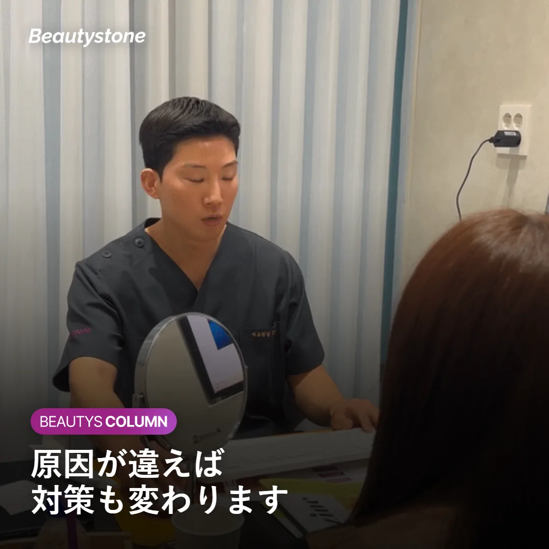 開き毛穴とたるみ毛穴の違いを示す図
