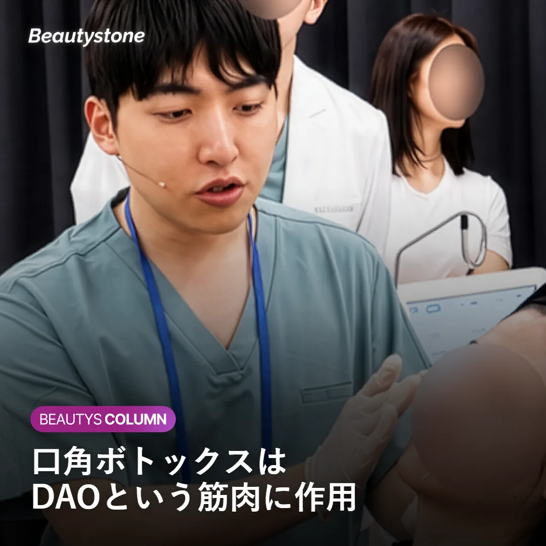 口角ボトックス(DAOへの施術)を示すイメージ