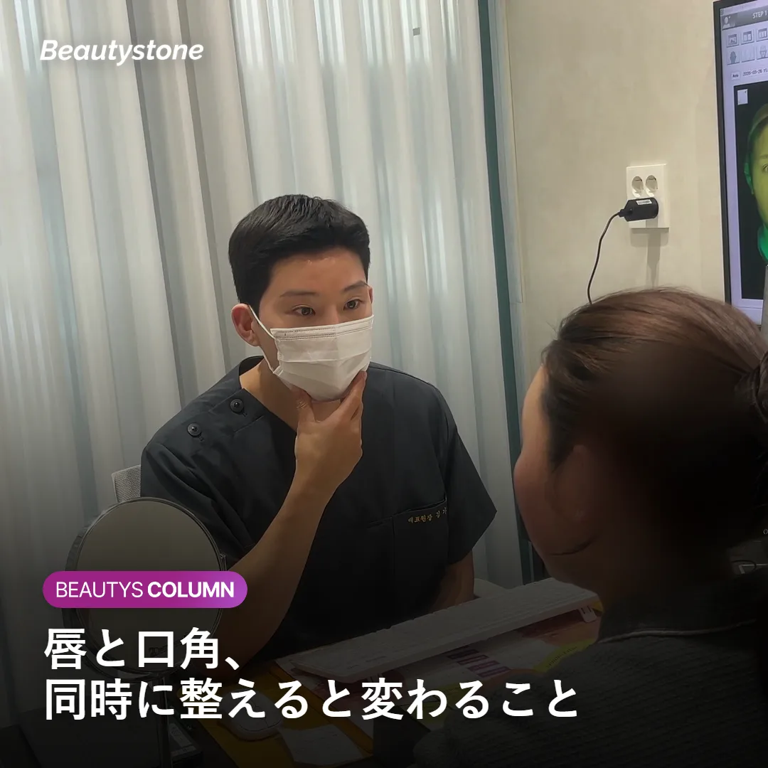 唇フィラーと口角ボトックスを併用した口元の変化を示すイメージ