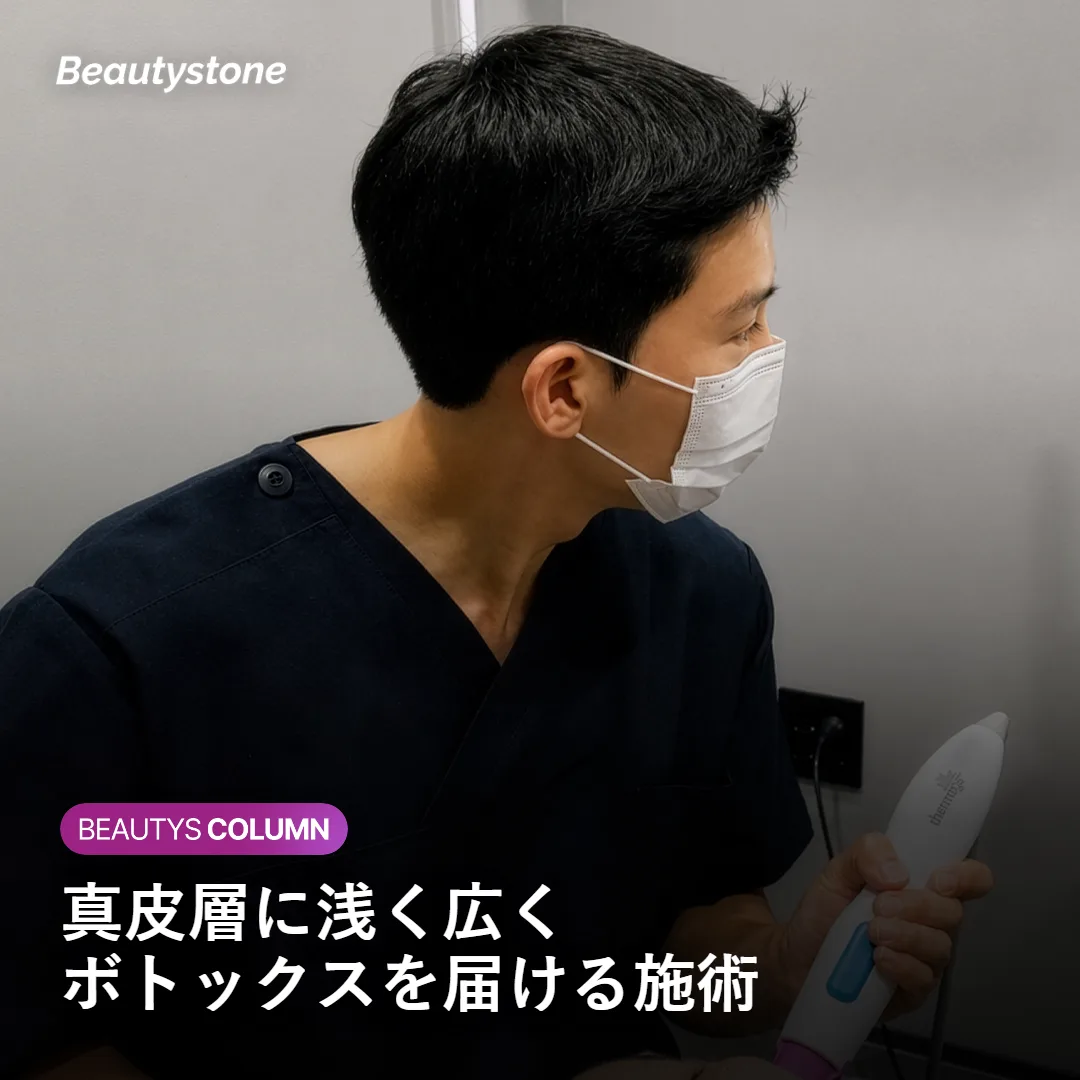 真皮層にボトックスを注入する施術のイメージ