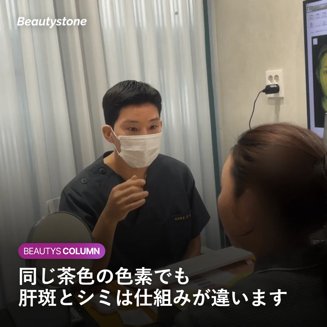 肝斑とシミの原因の違いを示す図