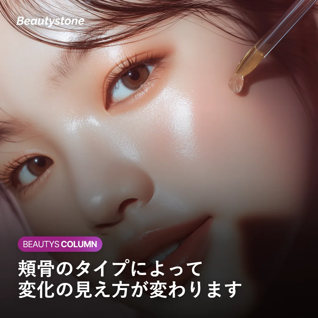 頬骨タイプ別にフィラーリフティングの変化を示す図