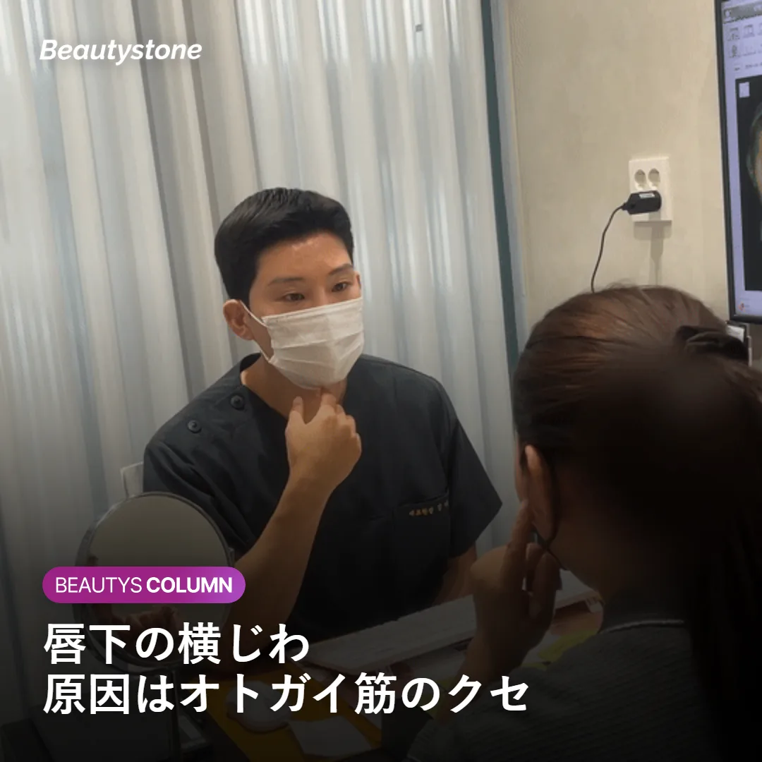 唇下の横じわの原因は「オトガイ筋」の使いすぎかもしれません
