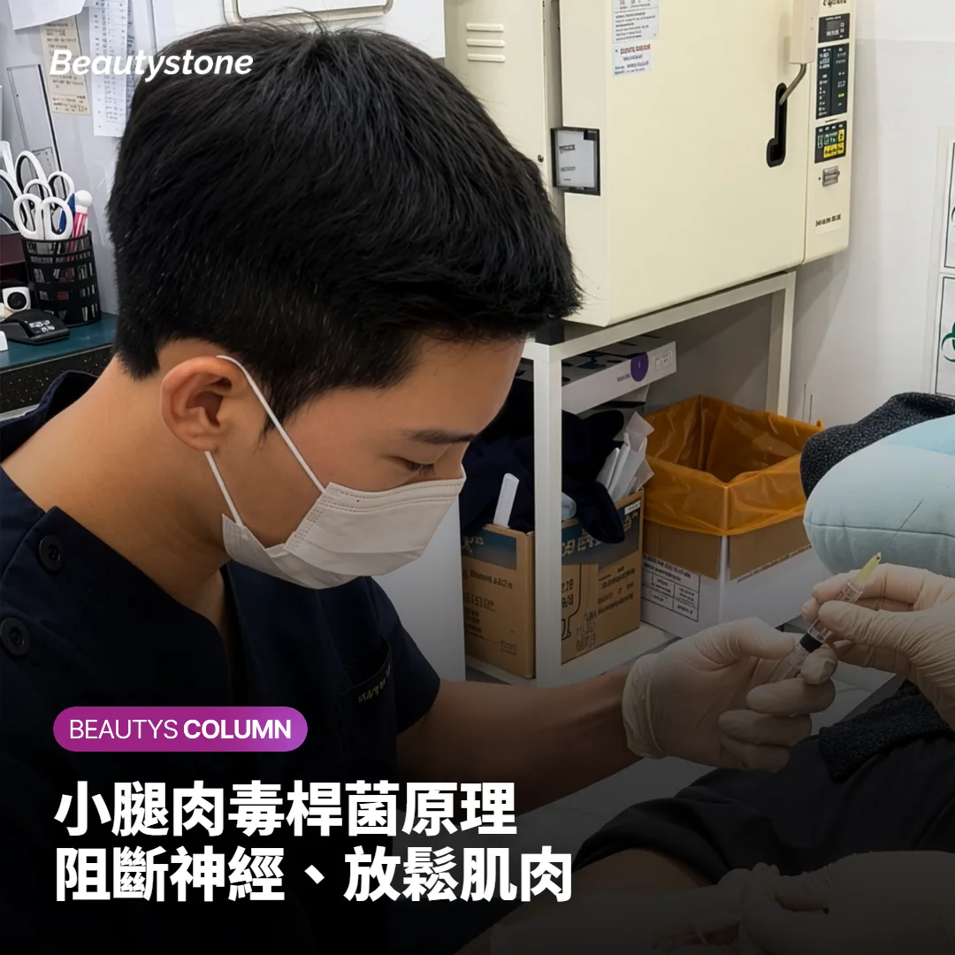 示意小腿肉毒桿菌阻斷神經訊號、讓腓腸肌放鬆的原理