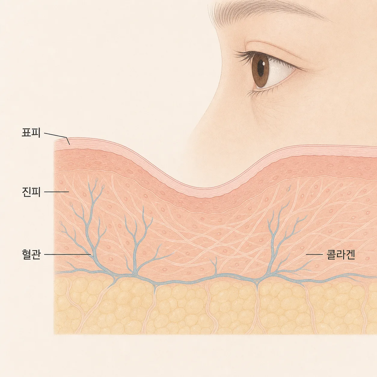 얇아진 눈 밑 피부와 비치는 혈관, 두꺼워지는 진피 구조