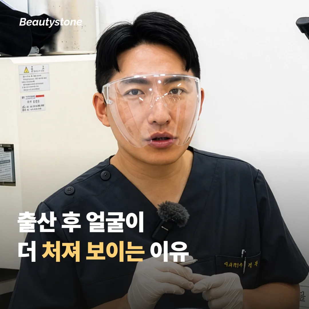 출산 후 얼굴이 더 처져 보이는 이유