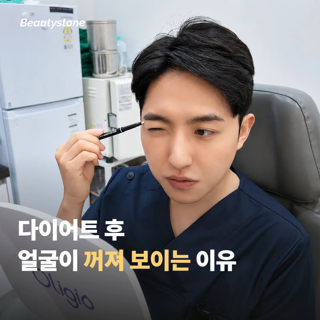 다이어트 후 얼굴이 꺼져 보이는 이유