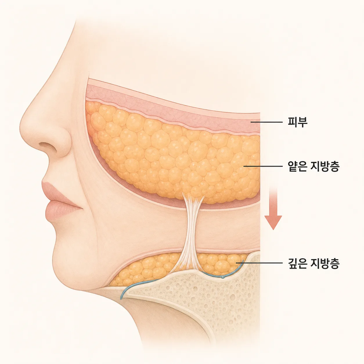 다이어트 후 깊은 지방층이 줄며 볼이 꺼지는 구조