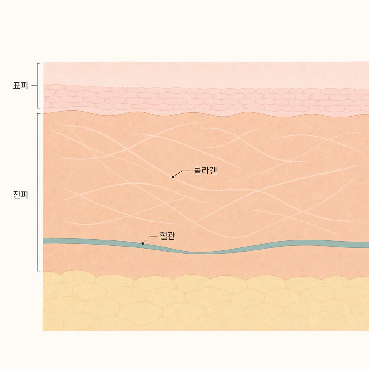 흡연으로 혈류가 줄고 콜라겐이 얇아지는 피부 구조