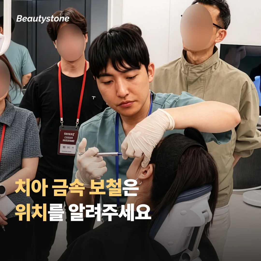 치아 금속 보철이나 임플란트가 있다면