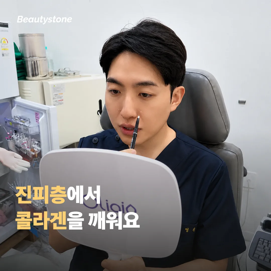 마이크로니들 RF가 흉터와 모공에 작용하는 원리