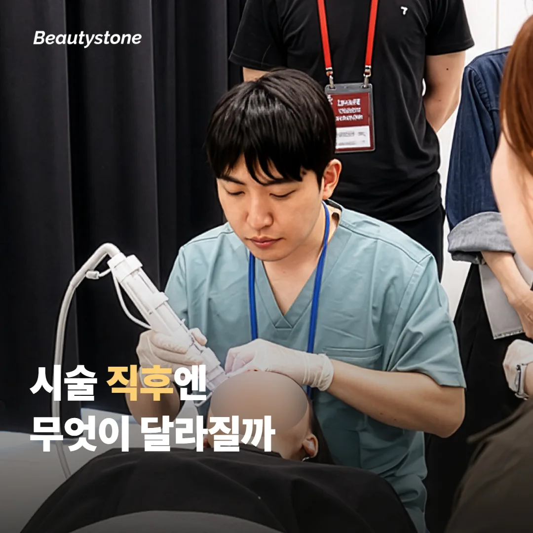 알티테 RF, 시술 직후엔 무엇이 달라질까