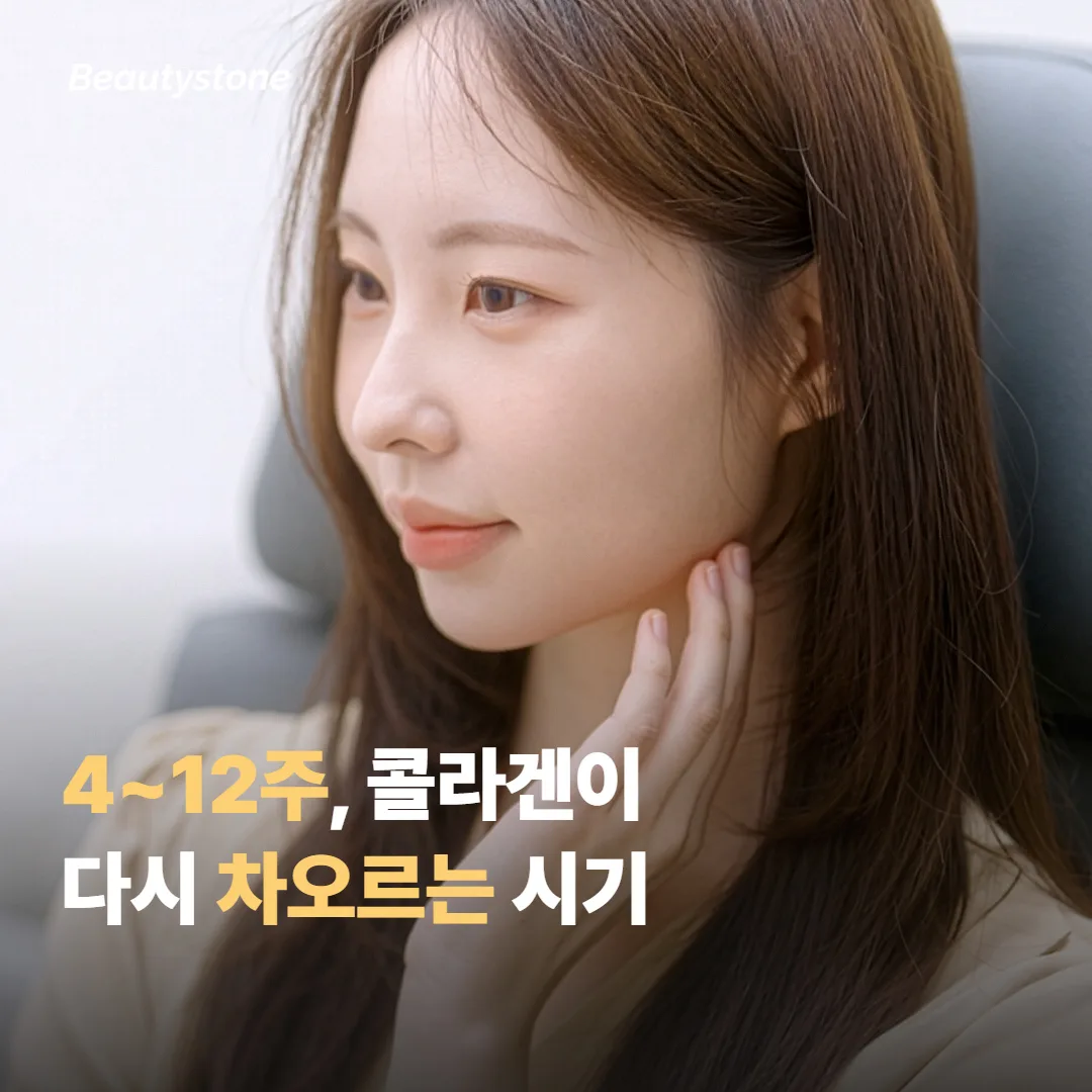 콜라겐이 다시 차오르는 4~12주, 본격 리프팅 체감 시기