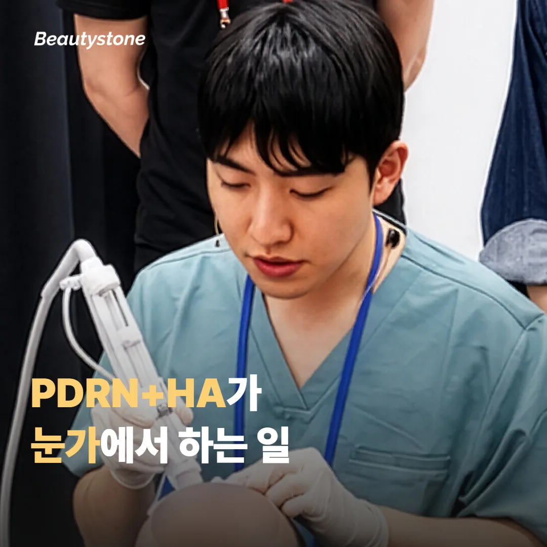 리쥬란 HB가 눈가에서 하는 일