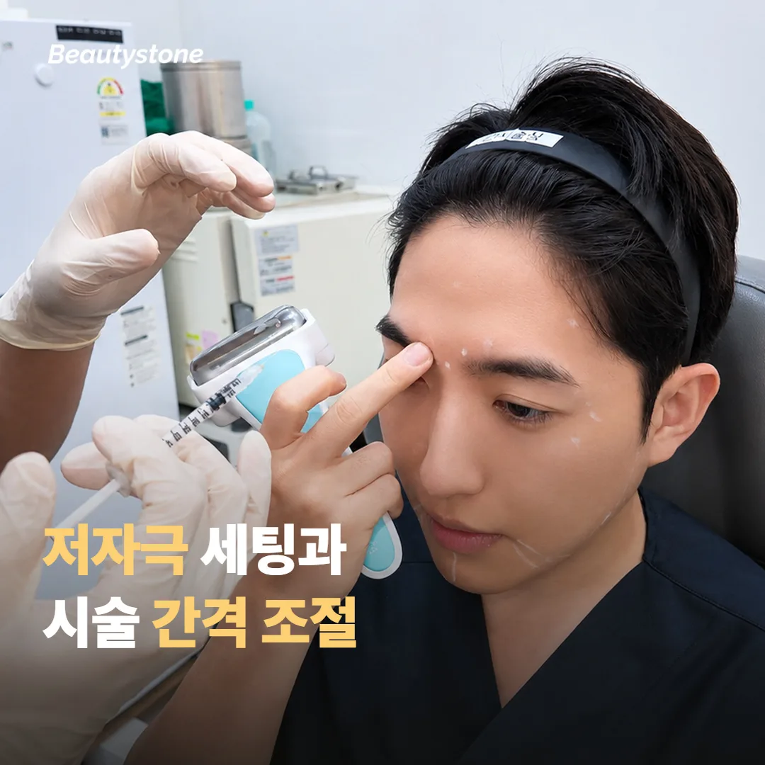자극을 줄이는 세팅과 시술 간격