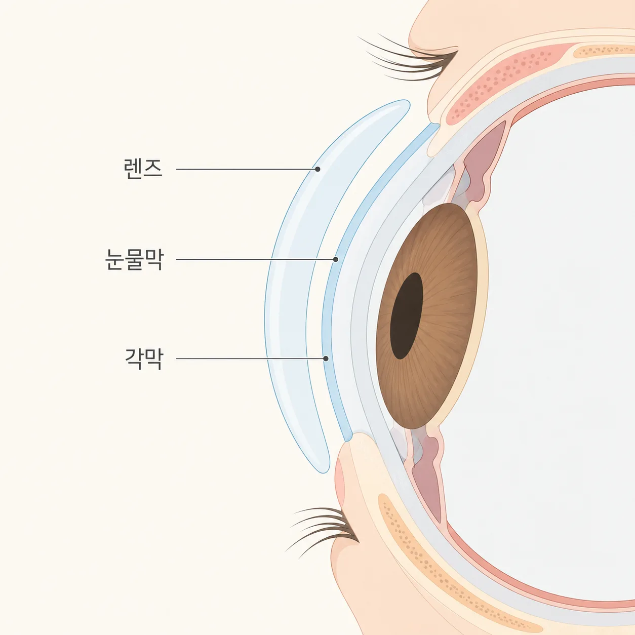 각막 위 눈물막과 그 위에 얹히는 콘택트렌즈