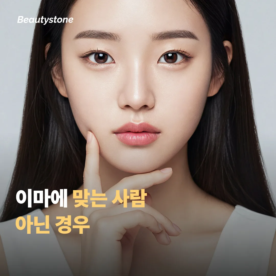 이마 볼륨에 맞는 사람과 아닌 경우