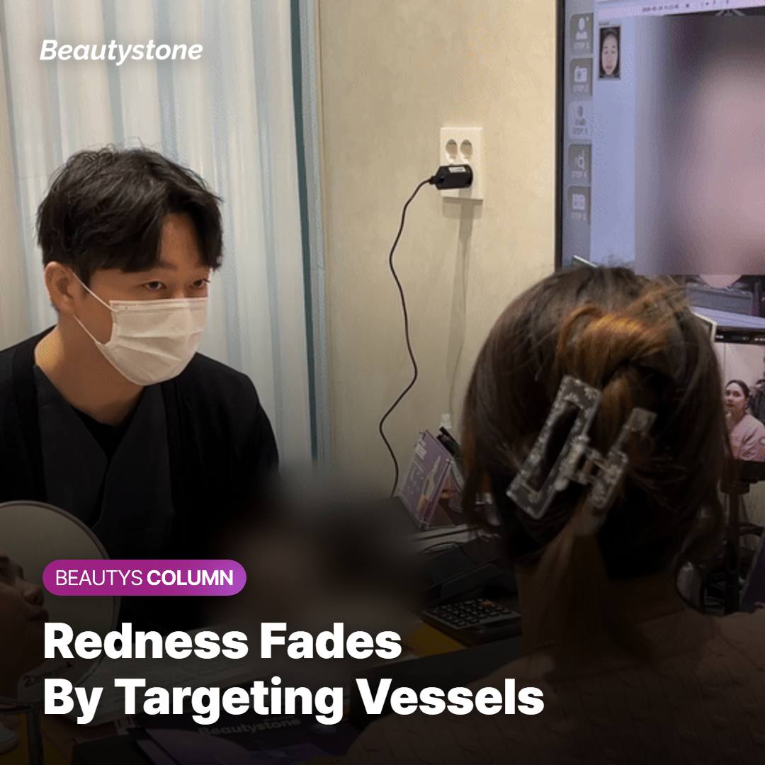 How 1064 nm targets hemoglobin to address facial redness