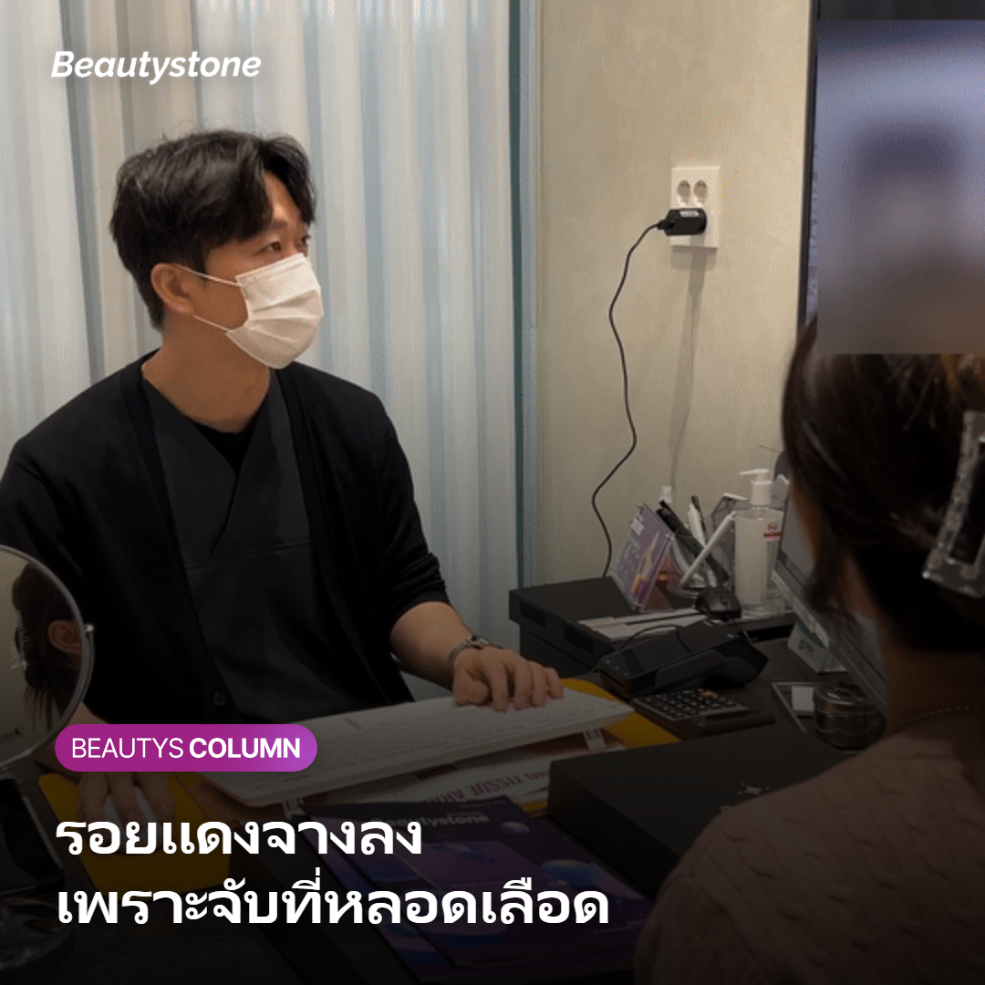 ภาพแสดงคลื่น 1064 นาโนเมตรจับฮีโมโกลบินเพื่อดูแลรอยแดง