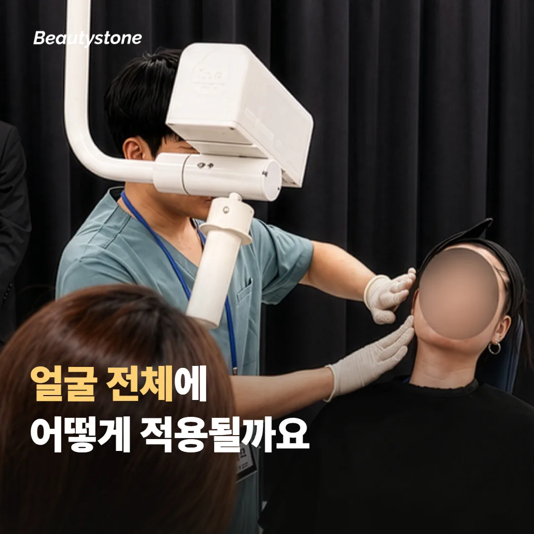 티타늄 리프팅이 얼굴 전체에 적용되는 방식