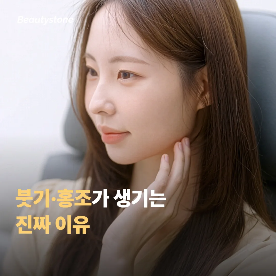 붓기와 홍조가 생기는 이유, 시술 원리에서 시작해요