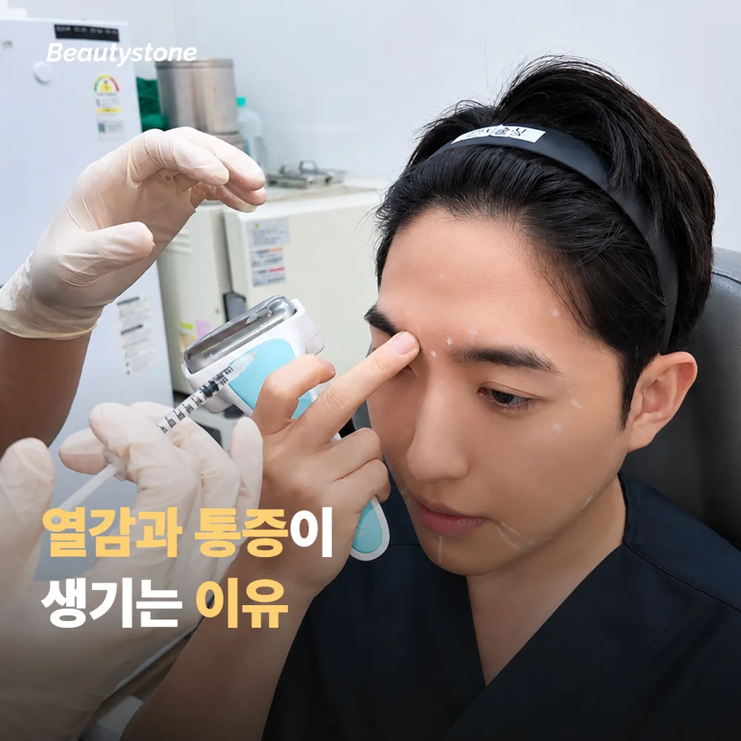 인모드 FX 가 열감과 통증을 만드는 원리
