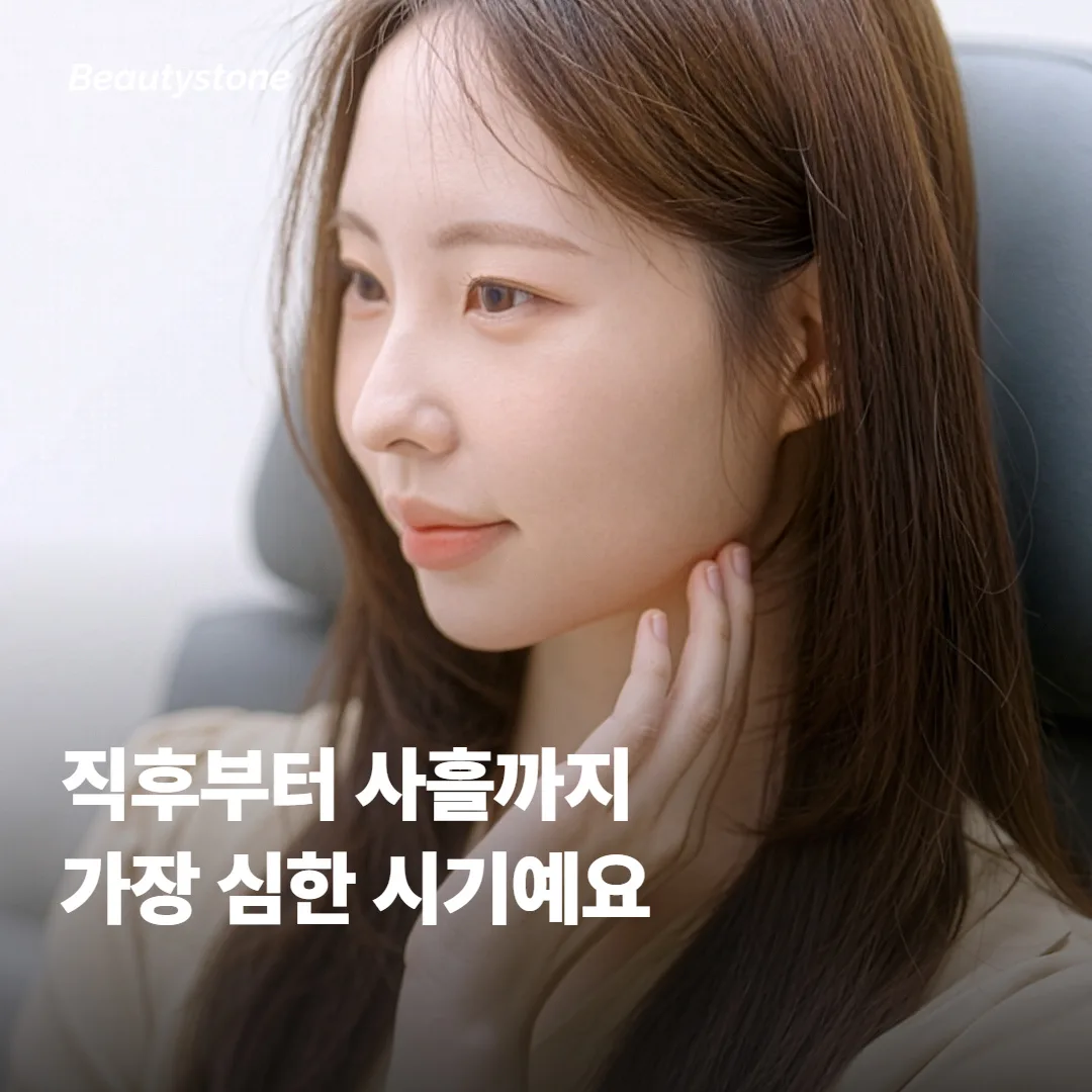 시술 직후부터 사흘까지 붓기와 멍이 가장 심한 시기