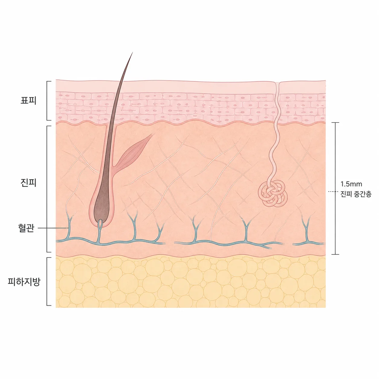 혈관이 좁아지며 피부로 가는 혈류와 산소가 줄어드는 모습이에요