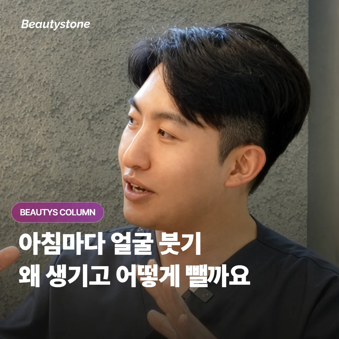 아침마다 얼굴이 붓는 이유는 무엇이고, 집에서 붓기를 빼려면 어떻게 관리하면 좋을까요?