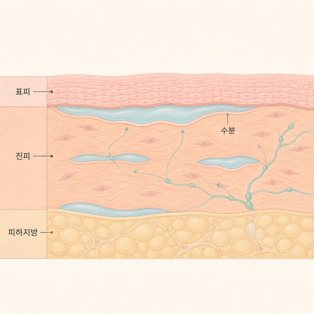 얼굴 조직 사이에 수분이 고여 붓기가 생기는 모습이에요