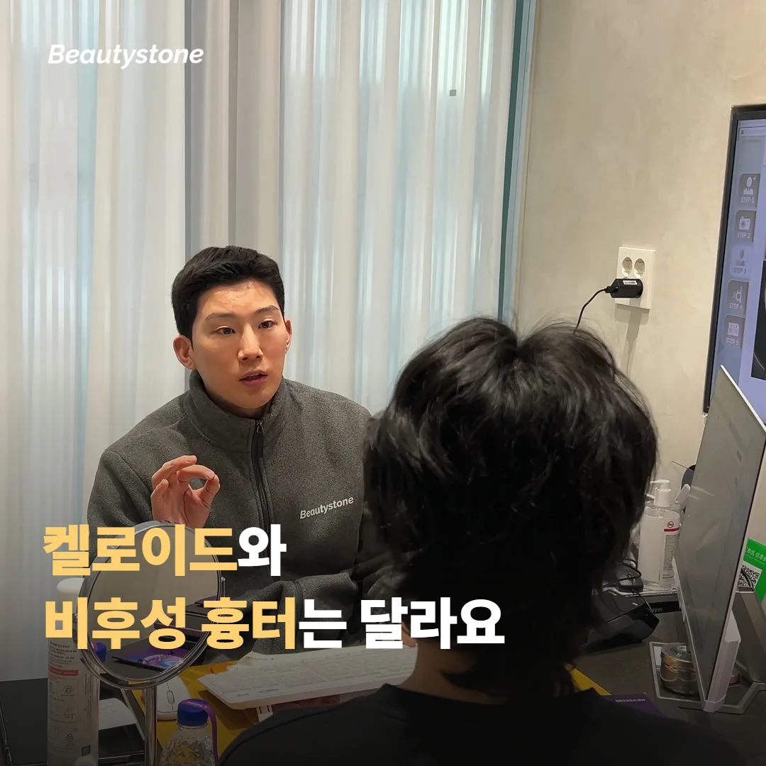켈로이드와 비후성 흉터는 다른 이야기예요