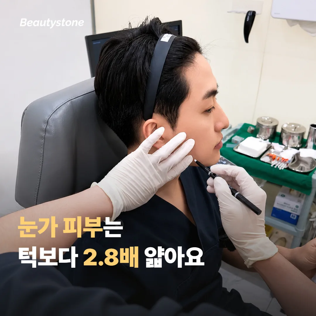 눈가와 눈밑 피부가 다른 부위와 다른 점