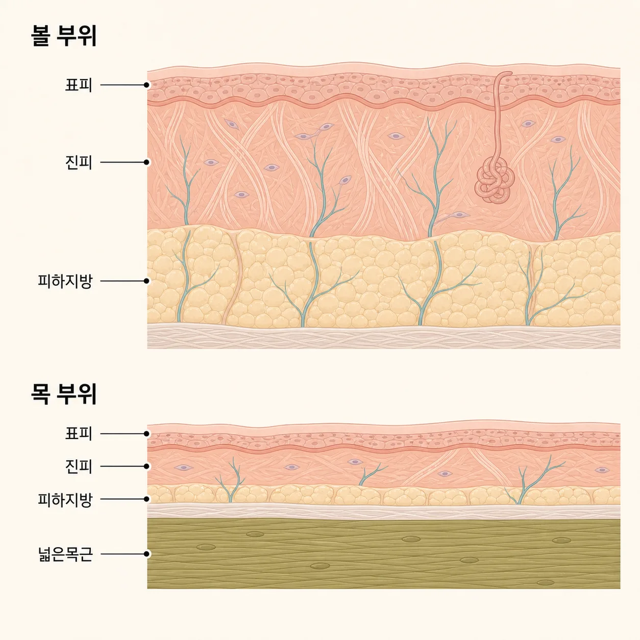 볼과 목은 피부 두께도 아래 구조도 서로 달라요