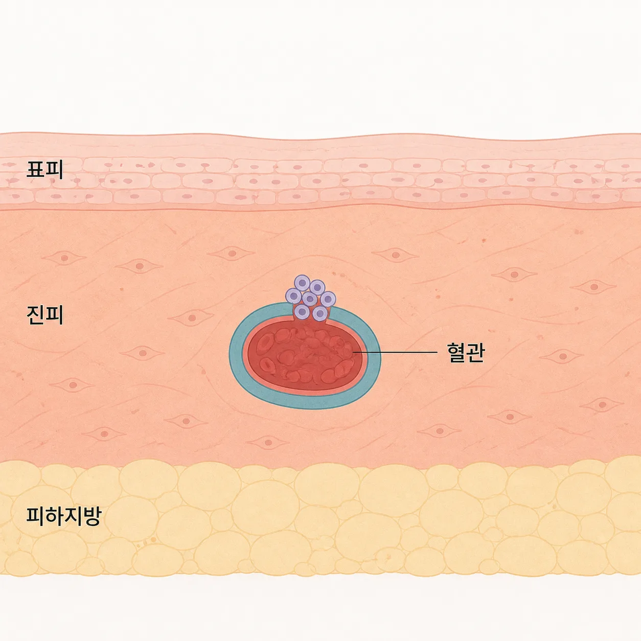 피부 속 작은 혈관과 출혈이 멎는 자리
