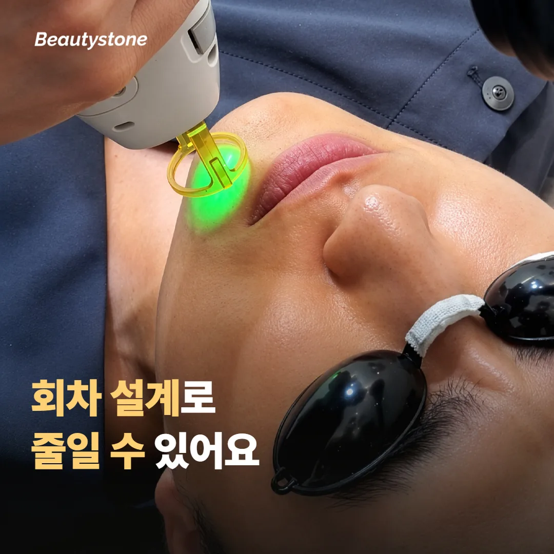 회차 설계로 줄이는 방법