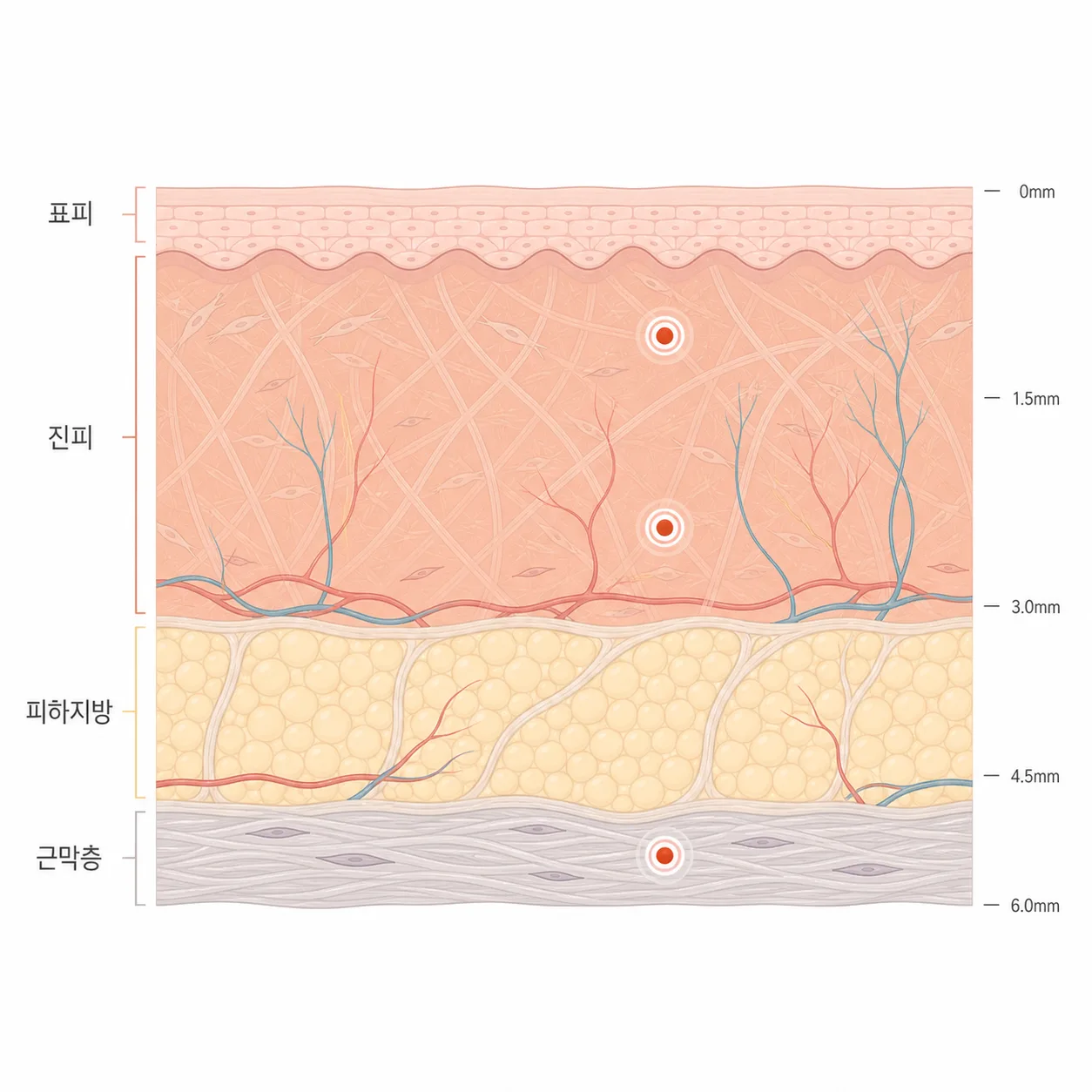 초음파 에너지가 모이는 깊이별 자리