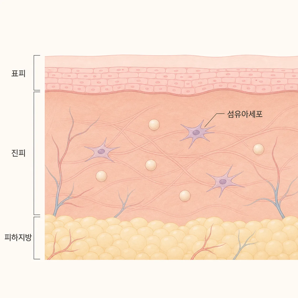 입자가 남은 자리에서 콜라겐이 만들어지는 과정