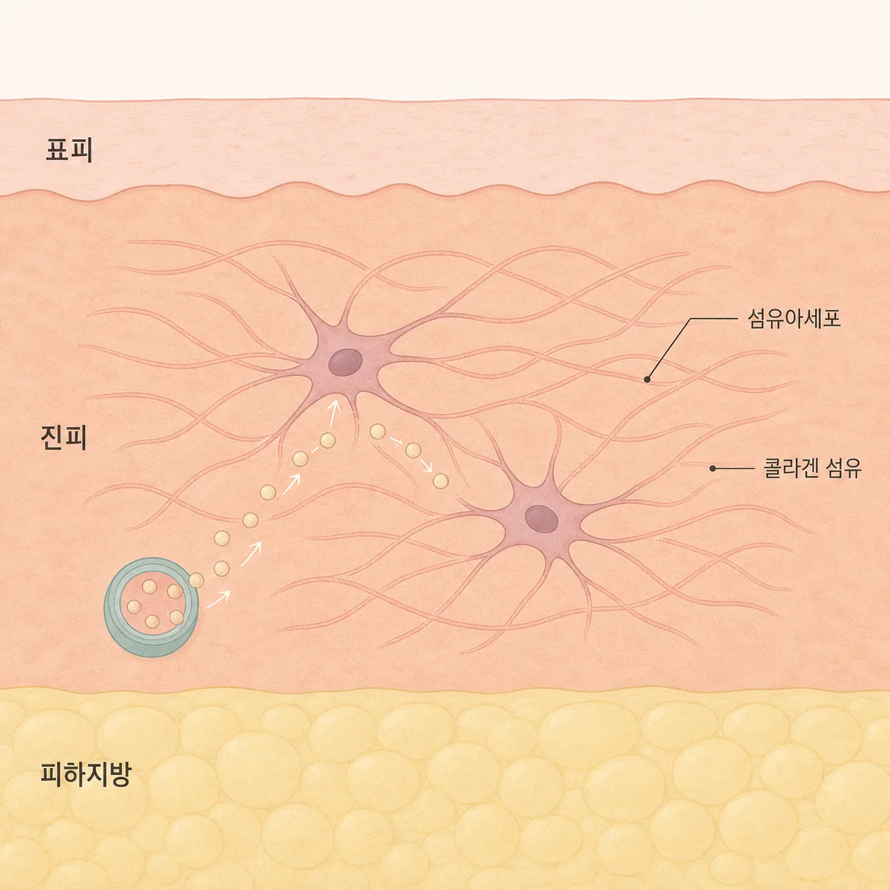 섬유아세포가 재료를 받아 콜라겐을 짓는 자리