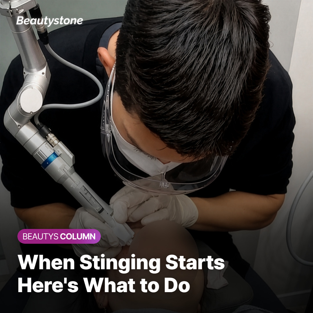 What to Do the Moment the Stinging Starts