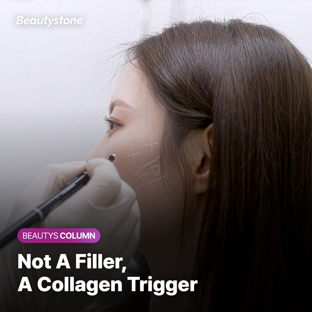 What Is Sculptra?