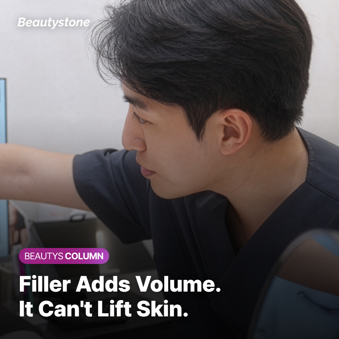 Why One Filler Doesn't Fit All Nasolabial Folds