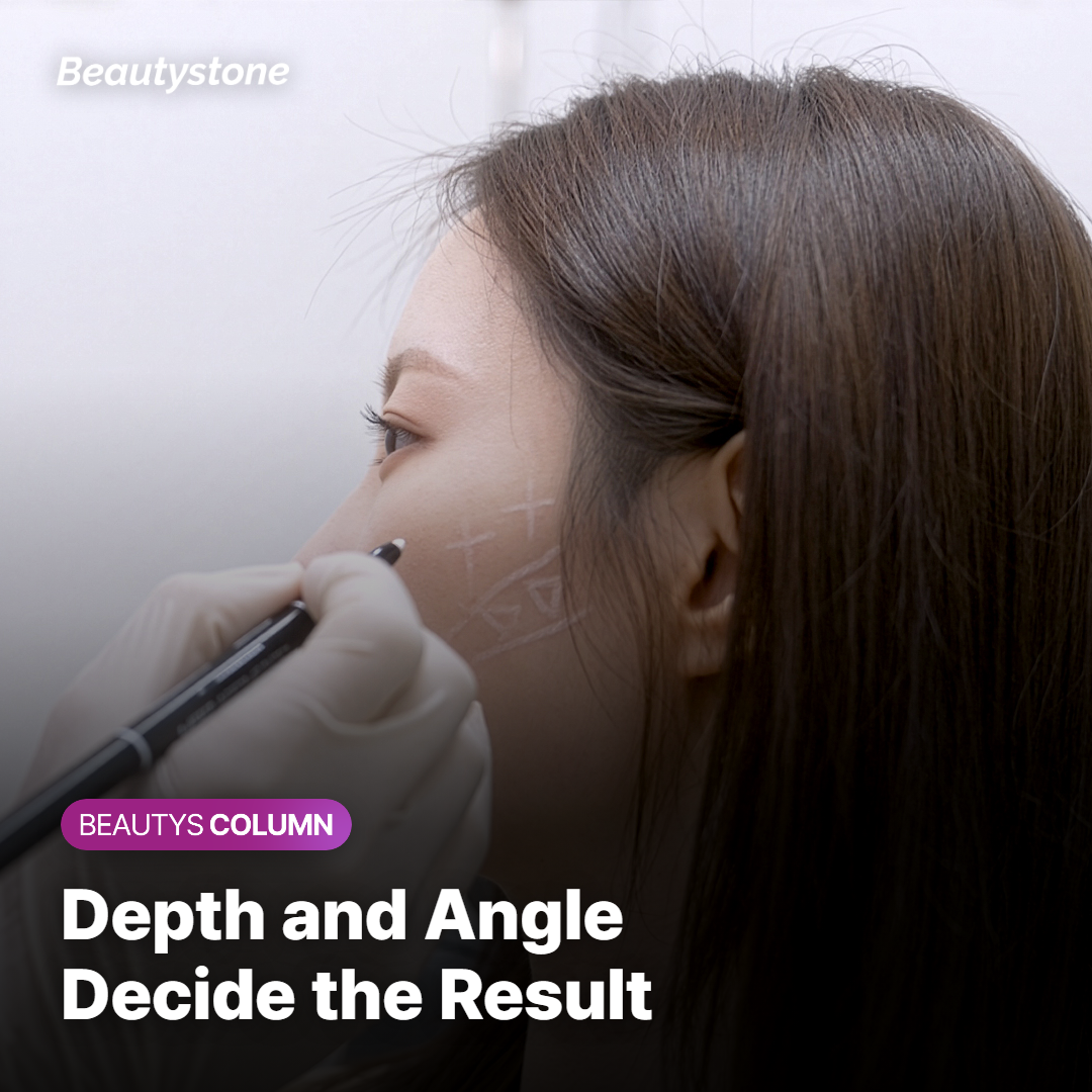 Why Injection Technique Matters More Than the Product